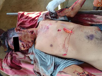 Civil Servant Shot Dead by Armed Terrorists in Mahlaing Township of Mandalay Region.