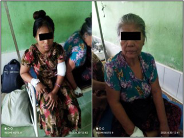 ပဲခူးတိုင်းဒေသကြီး၊ ဝေါမြို့နယ်၌ KNU အဖွဲ့မှ အကြမ်းဖက်မှုကို လိုလားသူများနှင့် PDF အမည်ခံ အကြမ်းဖက်သမားများ ပူးပေါင်းအဖွဲ့က ကျေးရွာအတွင်းသို့ Drone ဖြင့် Drop Bomb များ ပစ်ချ တိုက်ခိုက်ခဲ့မှုကြောင့် အပြစ်မဲ့ အရပ်သားပြည်သူ တစ်ဦး သေဆုံးကာ နှစ်ဦး ထိခိုက်ဒဏ်ရာရရှိ မှတ်တမ်းဓာတ်ပုံ။