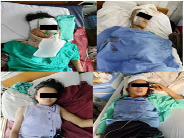 One man and nine women were injured in IED explosion in Hmawbi Township of Yangon Region.