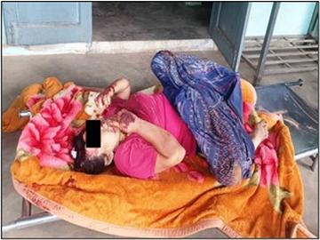 မန္တလေးတိုင်းဒေသကြီး၊ ညောင်ဦးမြို့နယ်၊ ကုန်းဘုရား(ညောင်ပင်ကန်)ကျေးရွာ၌ PDF အမည်ခံ  အကြမ်းဖက်သမားများက လုပ်ကြံသတ်ဖြတ်မှုကြောင့် အခြေခံပညာအထက်တန်းကျောင်း(ခွဲ)မှ  ကျောင်းအုပ်ဆရာမကြီးနှင့် ခင်ပွန်းဖြစ်သူတို့ နှစ်ဦး သေဆုံးမှု မှတ်တမ်းဓာတ်ပုံ။