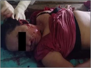 An innocent civilian and a child were killed and two others civilians along with a child were injured in a drone bomb attack by a group of pro-terrorism KUN members along with so-called PDF terrorists in Kyauktaga Township of Bago Region.