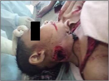 An innocent civilian and a child were killed and two others civilians along with a child were injured in a drone bomb attack by a group of pro-terrorism KUN members along with so-called PDF terrorists in Kyauktaga Township of Bago Region.