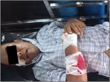 An innocent civilian and a child were killed and two others civilians along with a child were injured in a drone bomb attack by a group of pro-terrorism KUN members along with so-called PDF terrorists in Kyauktaga Township of Bago Region.
