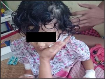 An innocent civilian and a child were killed and two others civilians along with a child were injured in a drone bomb attack by a group of pro-terrorism KUN members along with so-called PDF terrorists in Kyauktaga Township of Bago Region.