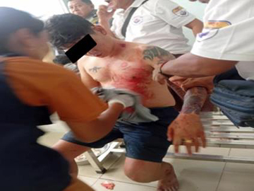 Four innocent civilians were injured and a vehicle was damaged by an explosive device planted by pro-terrorism KUN members and so-called PDF terrorists on the roadside of the Yangon-Mawlamyine Road in Kyaikto Township of Mon State.