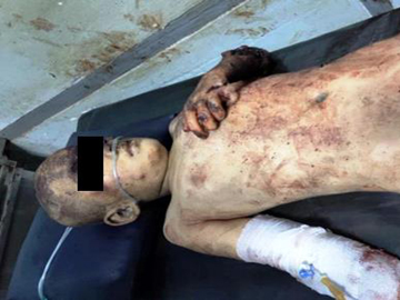 Six innocent civilians, including children were killed in a heavy weapon attack by an insurgent group in Kawkareik Township of Kayin State.