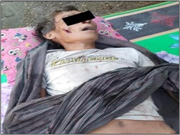  မကွေးတိုင်းဒေသကြီး၊ ပေါက်မြို့နယ်၌ PDF အမည်ခံ အကြမ်းဖက်အဖွဲ့က  ထောင်ထားသည့် နင်းမိုင်း တစ်လုံး ပေါက်ကွဲခဲ့မှုကြောင့် အပြစ်မဲ့  အရပ်သားပြည်သူ တစ်ဦး သေဆုံးမှု မှတ်တမ်းဓာတ်ပုံ။