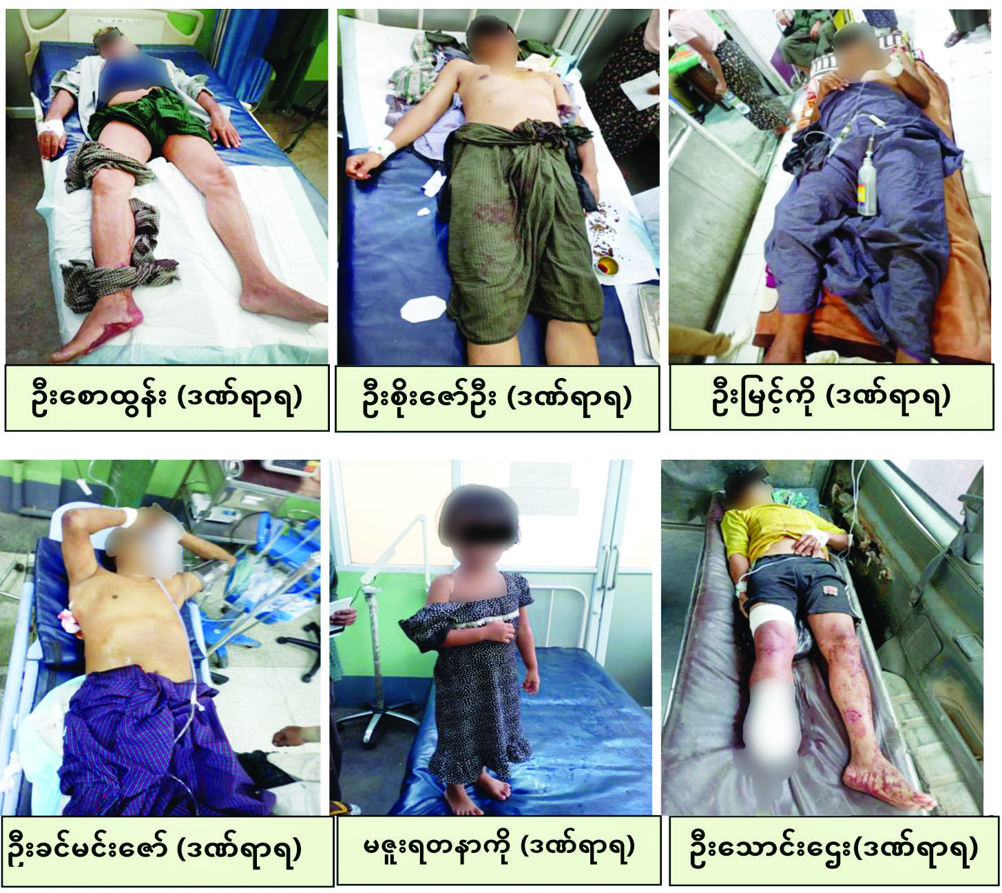 မန္တလေးတိုင်းဒေသကြီး၊ မတ္တရာမြို့နယ်အတွင်း PDF အမည်ခံအကြမ်းဖက်သမားများက လက်နက်ကြီးများဖြင့် ကျေးရွာအတွင်း အကြောင်းမဲ့ပစ်ခတ်ခြင်း၊ မိုင်းထောင်ခြင်းများကြောင့် ကလေးငယ် ၁ ဦးအပါအဝင် အပြစ်မဲ့ပြည်သူ ၆ ဦး ထိခိုက်ဒဏ်ရာရရှိ
