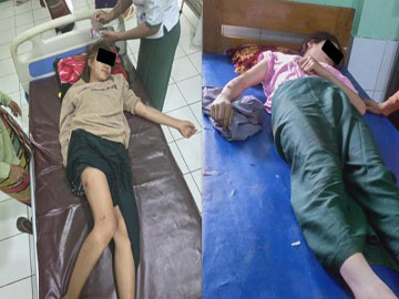 Two innocent civilians were injured in an explosion caused by an explosive device planted by a terrorist group in Hsihseng Township of Southern Shan State.