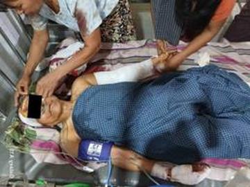 Six inncent civilians were injured in an attack by so-called PDF terrorists in Nyaung-U Township of Mandalay Region.
