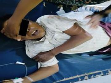 Six inncent civilians were injured in an attack by so-called PDF terrorists in Nyaung-U Township of Mandalay Region.