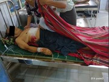 Six inncent civilians were injured in an attack by so-called PDF terrorists in Nyaung-U Township of Mandalay Region.