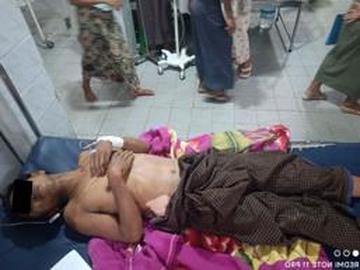 Six inncent civilians were injured in an attack by so-called PDF terrorists in Nyaung-U Township of Mandalay Region.