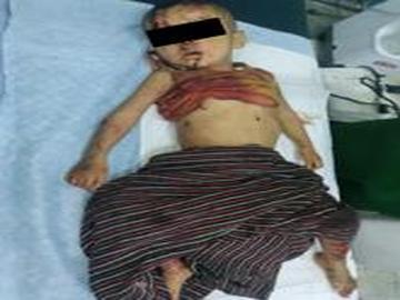 A child was killed and four other innocent civilians were injured in a heavy weapon attack by a so-called PDF terrorist group in Madaya Township of Mandalay Region.