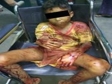 A child was killed and four other innocent civilians were injured in a heavy weapon attack by a so-called PDF terrorist group in Madaya Township of Mandalay Region.