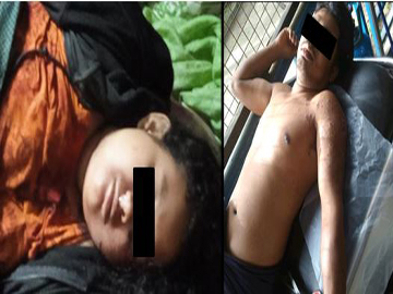 Innocent Civilian Shot Dead, Another Injured by Pro-Terrorism KNU Members and So-Called PDF Terrorists in Nyaunglebin Township of Bago Region