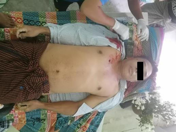 An innocent civilian was shot dead by so-called PDF terrorists  in Nyaung-U Township of Mandalay Region.