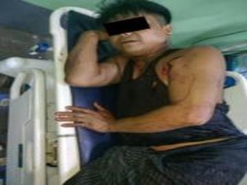 A child was killed and four other innocent civilians were injured in a heavy weapon attack by a so-called PDF terrorist group in Madaya Township of Mandalay Region.