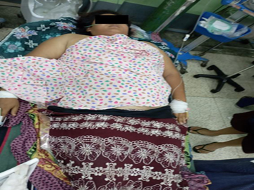 Innocent Civilian Injured in Attack by So-Called PDF Terrorists in Pakokku Township of Magway Region