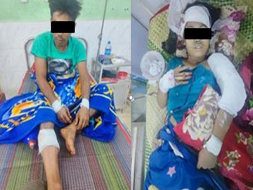 Three innocent civilians and a child were injured after explosion device planted by a group of pro-terrorism KNU members along with so-called PDF terrorists in Shwegyin Township of Bago Region.