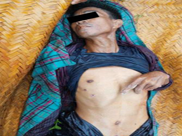 မကွေးတိုင်းဒေသကြီး၊ ဆင်ပေါင်ဝဲမြို့နယ်၌ PDF အမည်ခံ အကြမ်းဖက်သမားများက လုပ်ကြံသတ်ဖြတ် မှုကြောင့် အပြစ်မဲ့ အရပ်သားပြည်သူ နှစ်ဦး သေဆုံးမှုမှတ်တမ်းဓာတ်ပုံ။