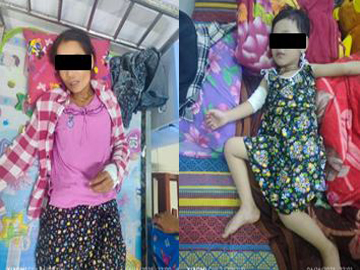 ပဲခူးတိုင်းဒေသကြီး၊ ရွှေကျင်မြို့နယ်၌ KNU အဖွဲ့မှ အကြမ်းဖက်မှုကို လိုလားသူများနှင့် PDF အမည်ခံ အကြမ်းဖက်အဖွဲ့(စိစစ်ဆဲ)က ထောင်ထားသည့် မိုင်း တစ်လုံး ပေါက်ကွဲခဲ့မှုကြောင့် ကလေးငယ် တစ်ဦး အပါအဝင် အပြစ်မဲ့ အရပ်သားပြည်သူ လေးဦး ထိခိုက်ဒဏ်ရာရရှိ