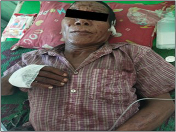 Two innocent civilians were injured by improvised explosive device planted by so-called PDF terrorist group in Pwintphyu Township of Magway Region.