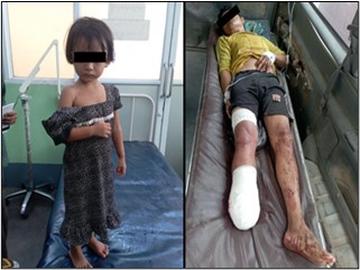 Six innocent civilians, including a child, injured in terrorist attacks by so-called PDF terrorists  in Madaya Township of Mandalay Region.