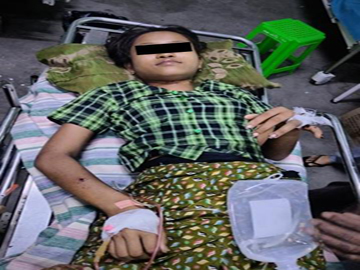 မန္တလေးတိုင်းဒေသကြီး၊ ငါန်းဇွန်မြို့နယ်၌ PDF အမည်ခံ အကြမ်းဖက်အဖွဲ့က ကျေးရွာအတွင်းသို့ လက်နက်ကြီးများဖြင့် ပစ်ခတ်တိုက်ခိုက်ခဲ့မှုကြောင့် အပြစ်မဲ့ အရပ်သားပြည်သူ နှစ်ဦး ထိခိုက်ဒဏ်ရာရရှိမှု မှတ်တမ်းဓာတ်ပုံ။
