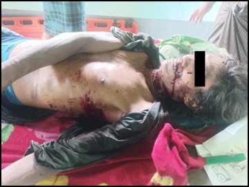 ပဲခူးတိုင်းဒေသကြီး၊ ကြို့ပင်ကောက်မြို့နယ်၌ KNU အဖွဲ့မှ အကြမ်းဖက်မှုကို လိုလားသူများနှင့် PDF အမည်ခံ အကြမ်းဖက်သမားများက ဓားဖြင့် ထိုးခုတ်သတ်ဖြတ်ခဲ့မှုကြောင့် အပြစ်မဲ့ အရပ်သား ပြည်သူ တစ်ဦး သေဆုံး
