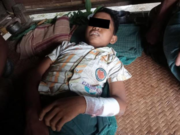 မကွေးတိုင်းဒေသကြီး၊ ပေါက်မြို့နယ်၌ PDF အမည်ခံ အကြမ်းဖက်အဖွဲ့ ထောင်ထားသည့် နင်းမိုင်း တစ်လုံး ပေါက်ကွဲခဲ့မှုကြောင့် အပြစ်မဲ့ အရပ်သားပြည်သူ တစ်ဦး ထိခိုက်ဒဏ်ရာရရှိမှု မှတ်တမ်းဓာတ်ပုံ။