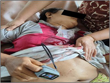 Three innocent civilians injured in a heavy weapon attack by pro-terrorism KNU members and so-called PDF terrorists in Kawkareik Township of Kayin State.