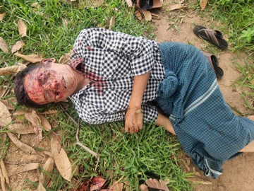 မကွေးတိုင်းဒေသကြီး၊ မကွေးမြို့နယ်၌ PDF အမည်ခံ အကြမ်းဖက်သမားများက သေနတ်ဖြင့် ပစ်ခတ်သတ်ဖြတ်ခဲ့မှုကြောင့် ရာအိမ်မှူး တစ်ဦး သေဆုံးမှု မှတ်တမ်းဓာတ်ပုံ။
