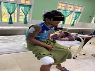 Three innocent civilians injured in heavy weapon attacks by Ta’ang National Liberation Army (TNLA) terrorist group in Kyaukme and Naungcho Townships of Shan State.
