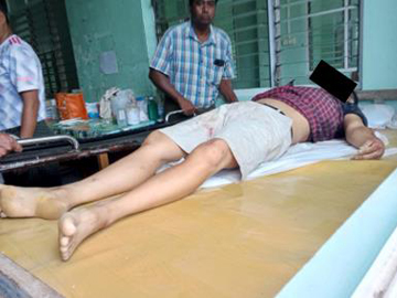 An innocent civilian killed in an attack by a so-called PDF terrorist group in Minhla Township of Magway Region. 