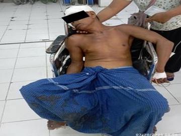     မန္တလေးတိုင်းဒေသကြီး၊ ပုသိမ်ကြီးမြို့နယ်နှင့် မတ္တရာမြို့နယ်တို့၌ PDF အမည်ခံ အကြမ်းဖက်အဖွဲ့က လက်နက်ကြီး/ လက်နက်ငယ်များဖြင့် ပစ်ခတ်တိုက်ခိုက်ခဲ့မှုကြောင့် ကလေးငယ်များအပါအဝင် အပြစ်မဲ့ အရပ်သားပြည်သူ နှစ်ဦး သေဆုံးကာ လေးဦး ထိခိုက်ဒဏ်ရာရရှိမှု မှတ်တမ်းဓာတ်ပုံ။
