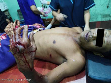 100-Household Elder Injured in Attack by Pro-Terrorism KNU Member and So-Called PDF Terrorist in Bilin Township of Mon State