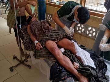   An innocent civilian was injured after stepping on an explosive device planted  by a so-called PDF terrorist group in Sidoktaya Township of Magway Region. 