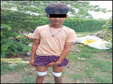  Two innocent civilians injured in an improvised rocket attack by a so-called  PDF terrorist group in Madaya Township of Mandalay Region.