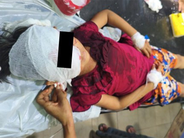 Innocent Civilian Injured in Heavy Weapon Attack by So-Called PDF Terrorist Group in Kyauktaga Township of Bago Region