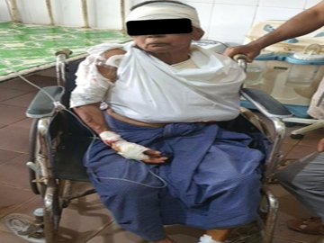 Two Innocent Civilians Injured in Improvised Rocket Attack by Pro-Terrorism KNU Members and So-Called PDF Terrorists in Kawkareik Township of Kayin State