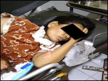 Three Innocent Civilians Injured in Drone Bomb Attack by So-Called PDF Terrorist Group in Tanintharyi Township of Taninthryi Region
