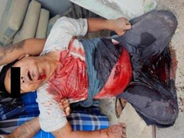 A man shot dead in Thal Kone Village, Patheingyi Township of Mandalay Region.