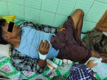 Man Injured by Explosion near Moke Kha Mu Village in Nyaunglebin Township of Bago Region.