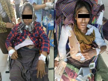Two innocent civilians injured by heavy weapon shell explosion in Myay Net Village, Ayartaw Township of Sagaing Region.