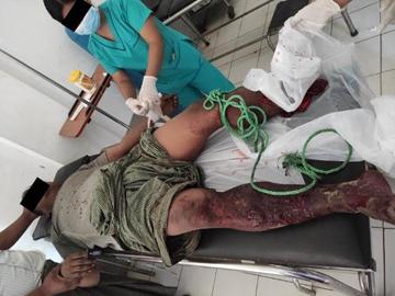 Terrorists carried out inhumane acts using explosive devices by capitalizing on unguarded moments of security personnel
