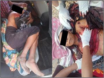မကွေးတိုင်းဒေသကြီး၊ ရေနံချောင်းမြို့နယ်၌ PDF အမည်ခံ အကြမ်းဖက်အဖွဲ့က ထောင်ထားသည့် မိုင်း တစ်လုံး ပေါက်ကွဲခဲ့မှုကြောင့် သာသနာ့အနွယ်ဝင် သံဃာတော် တစ်ပါးနှင့် အပြစ်မဲ့ အရပ်သား ပြည်သူ တစ်ဦး သေဆုံး