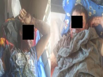 Innocent Civilian Killed, Another Injured in Explosion of Device Planted by So-called PDF Faction in Salin Township of Magway Region.