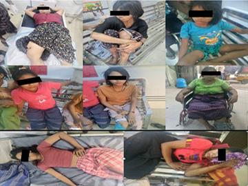 Eight innocent civilians injured in heavy weapon shell explosion in Mya Kan Thar Village, Patheingyi Township of Mandalay Region.