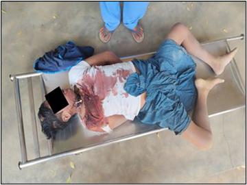 A civil servant and an innocent civilian recklessly assassinated by armed terrorists in Nyaung-U Township of Mandalay Region.